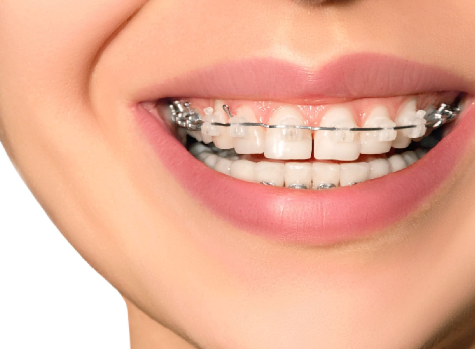 Autoligable de Zafiro